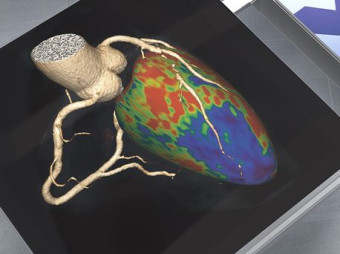 CT Cardio-Vascular Engine